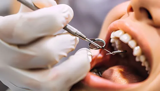 牙医给年轻女士检查牙齿图片素材(JPG)四